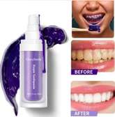 Glory Smile – Blanchiment des dents